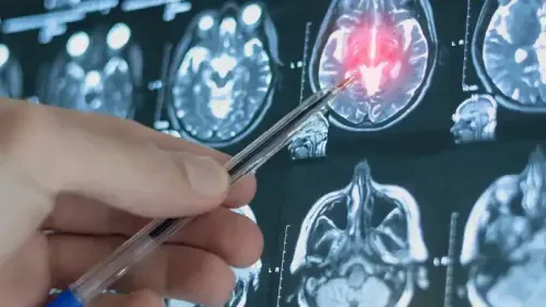 What is Vermis Syndrome?